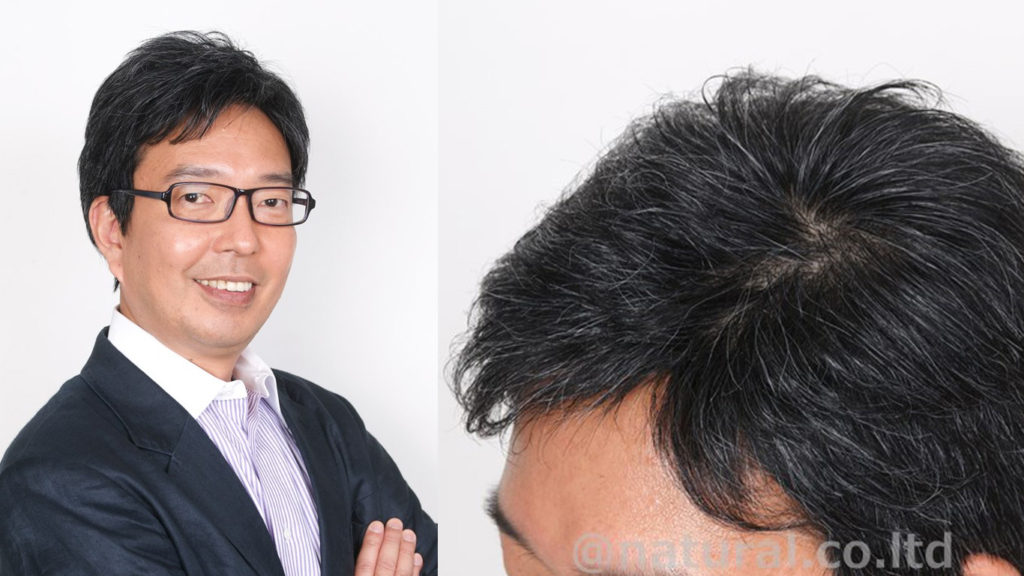 医療用ウィッグ男性用白髪入りの参考写真