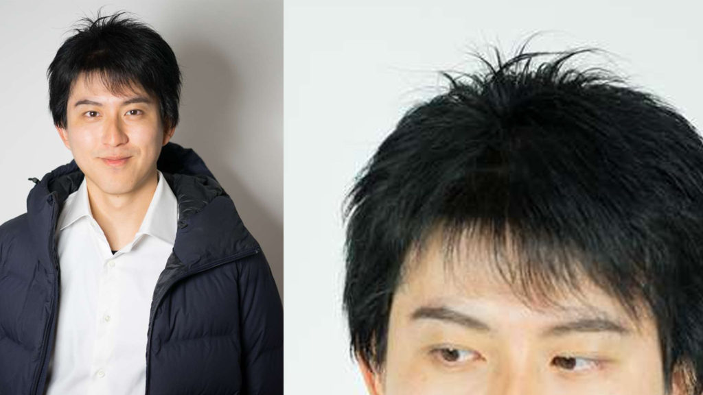 医療用ウィッグ男性用黒髪の参考写真