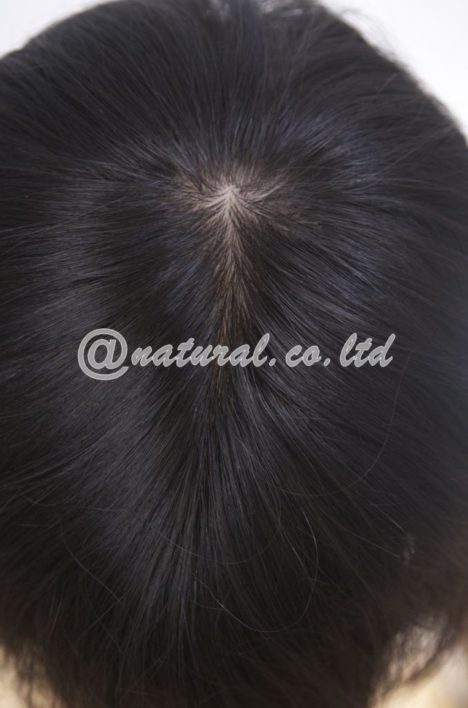 スキンフェイスの生え際写真