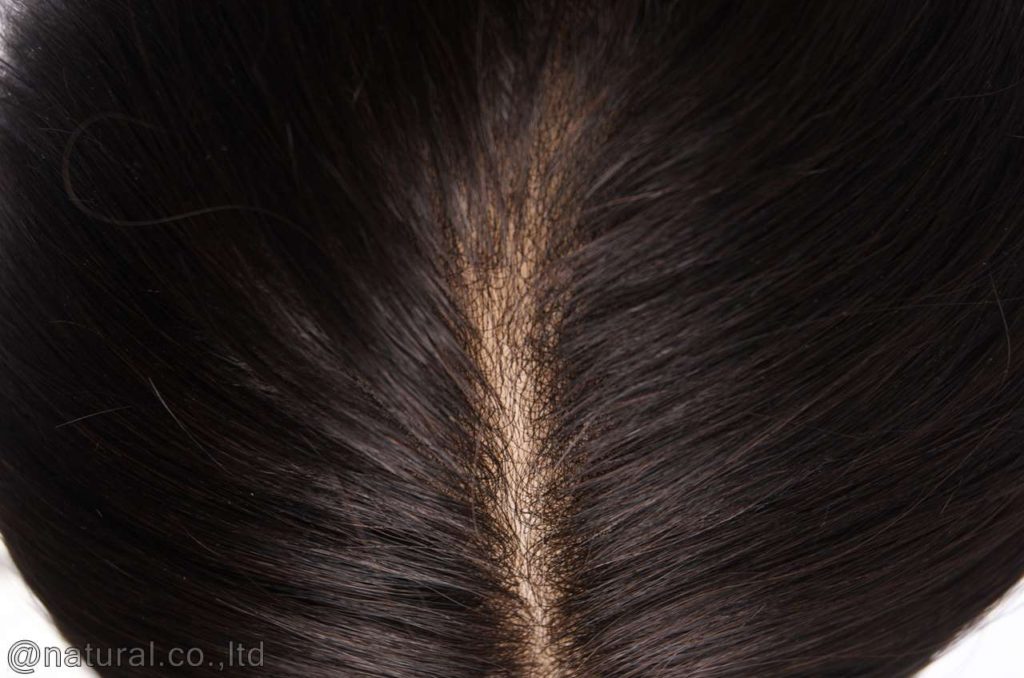 スキンフェイスの写真